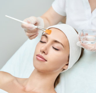 Chemical Peel